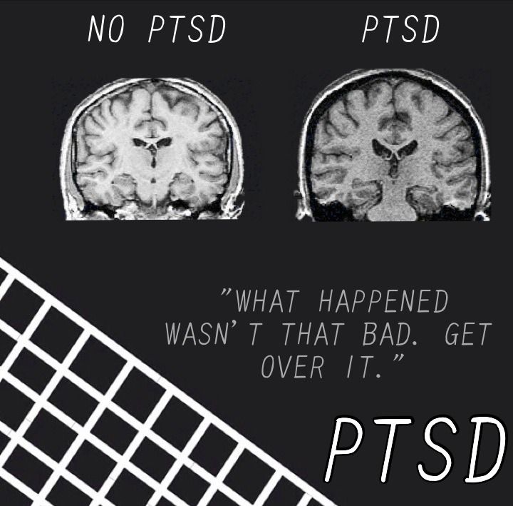 17 Best images about PTSD: Mind Under Matter on Pinterest