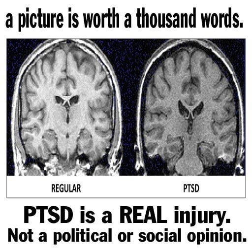 39 best PTSD images on Pinterest