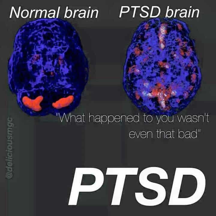 601 best Complex PTSD: Post