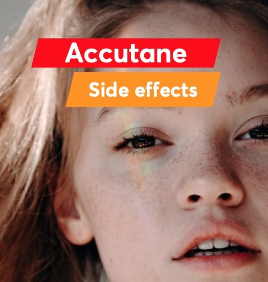 Accutane Side Effects
