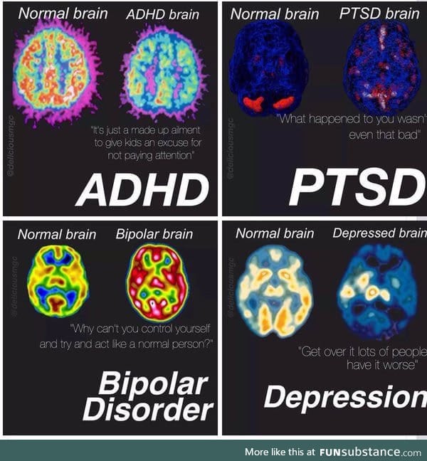 ADHD, PTSD, Bipolar and Depression