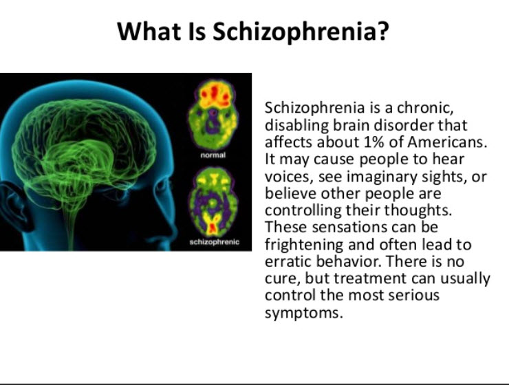 Causes of Schizophrenia and it