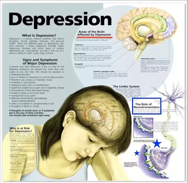 Does depression cause permanent brain damage? I