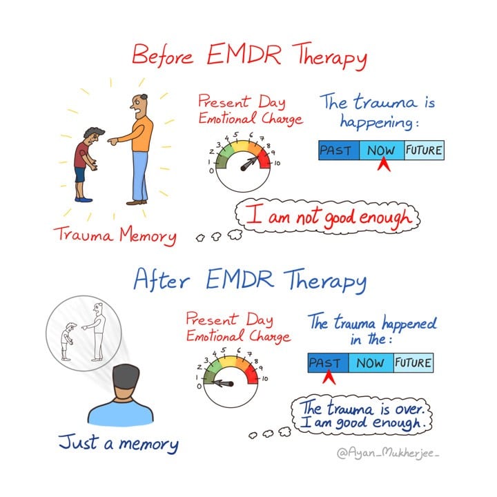 EMDR Therapy for Trauma Recovery