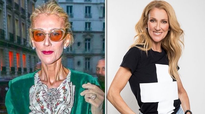 Fans express concern after photos of thin Celine Dion ...