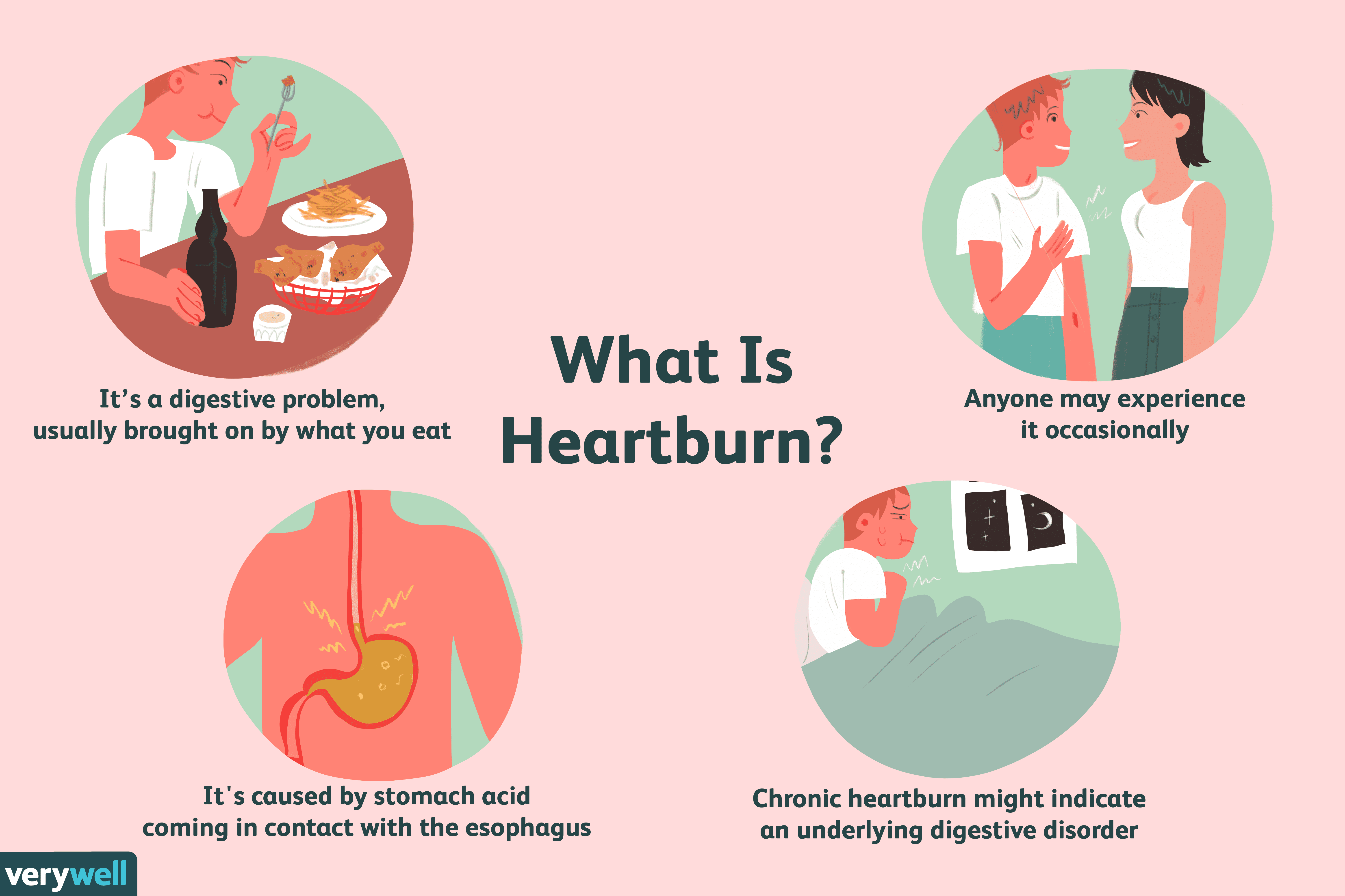Heartburn Symptoms Causes Diagnosis And Treatment