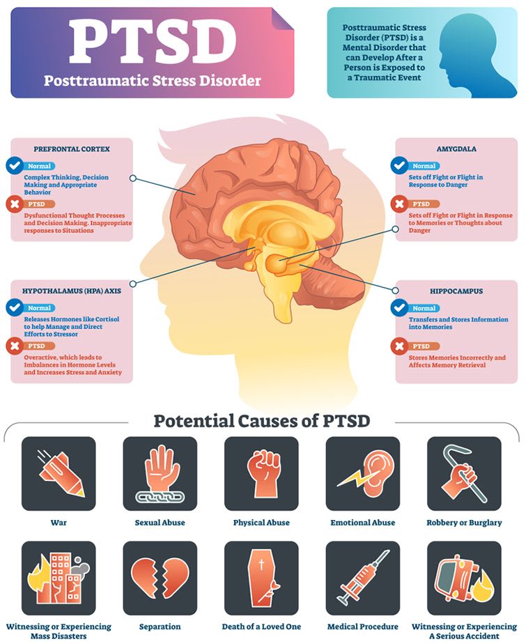How Post Traumatic Stress Disorder Affects The Brain