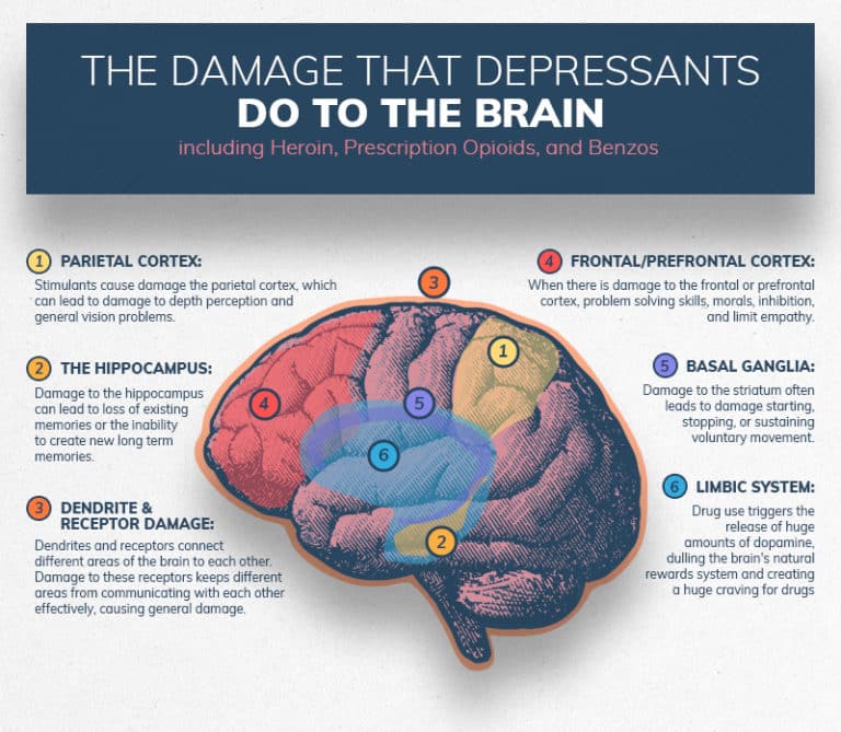 Infographics show the damage substance abuse can do to the brain