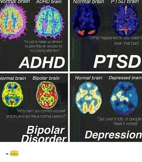 Normal Brain ADHD Brain Normal Brain PTSD Brain What Happened to You ...