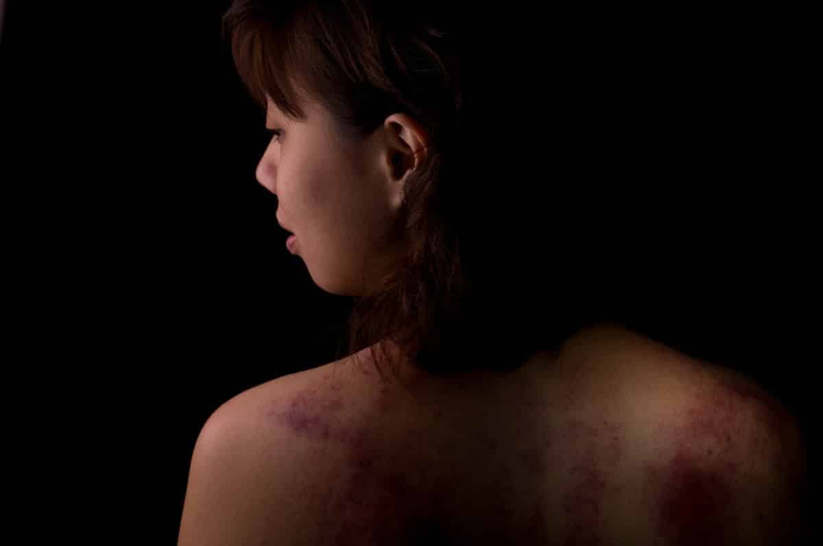 PTSD Due to Domestic Violence