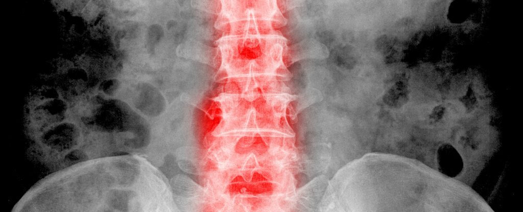 Research Says Back Pain Can Be Caused by Depression