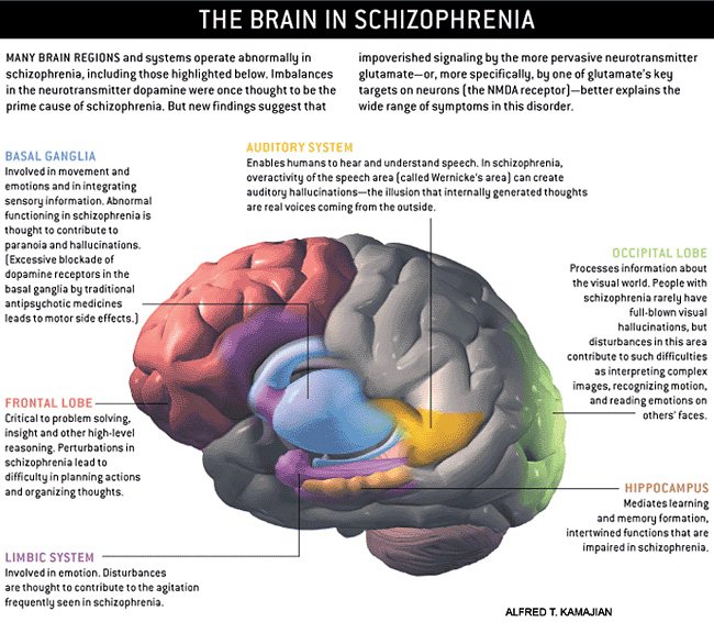 Schizophrenia and the Risks of Substance Abuse