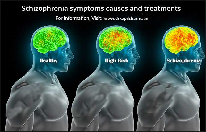 Schizophrenia symptoms causes and treatments