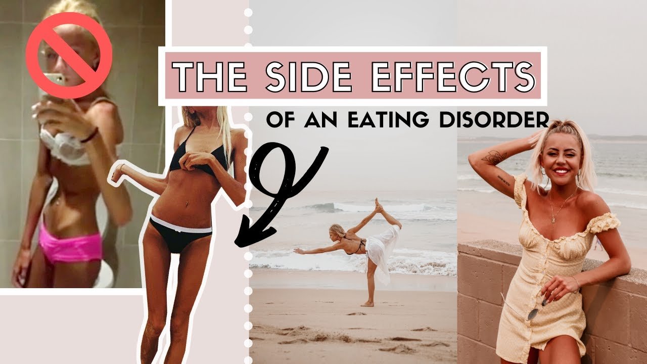 What to expect in recovery from an eating disorder