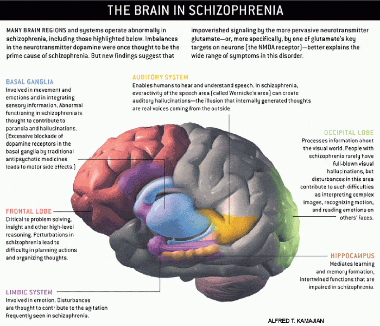 Young adults with schizophrenia face highest suicide risk, study says ...